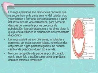 Esquema de las deformaciones dentales y palatinas causadas por el uso prolongado de chupetes y biberones
