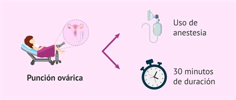 Ilustración médica mostrando el procedimiento de punción ovárica