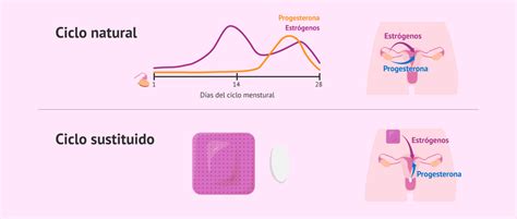 Esquema de preparación endometrial (ciclo natural vs. sustituido)