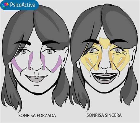 Infografía comparativa: diferencia entre la sonrisa refleja (involuntaria, durante el sueño) y la sonrisa social (activa, despierto, ante estímulos externos).