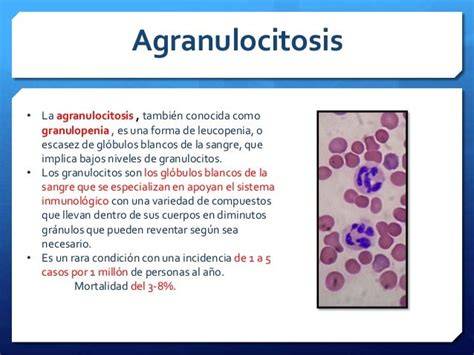 Infografía: Qué es la agranulocitosis y sus síntomas clave