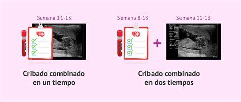 Infografía: Componentes del cribado combinado del primer trimestre