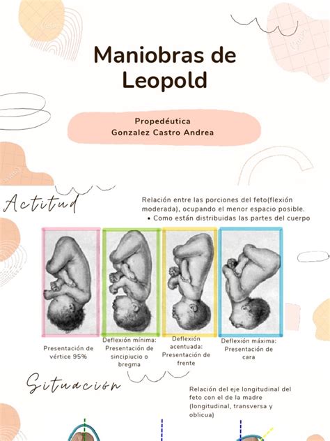 Ilustración de las cuatro Maniobras de Leopold