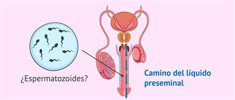 Infografía: Presencia de espermatozoides en el líquido preseminal: Mitos y Realidades