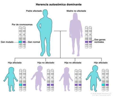 Esquema de la herencia autosómica dominante en la exostosis múltiple hereditaria