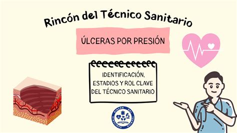 Infografía comparativa del tiempo de cicatrización de úlceras por presión con tratamiento estándar frente a tratamiento con aloinjerto de membrana amniótica