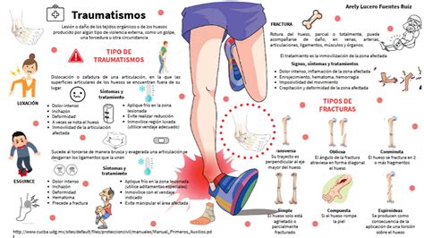 Esquema sobre la mecánica de los traumatismos cerrados y el efecto amortiguador del líquido amniótico y el miometrio