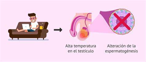 Infografía comparativa: temperatura escrotal normal frente a la elevación térmica causada por el uso de dispositivos electrónicos sobre las piernas.