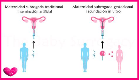 Infografía explicativa sobre el método de gestación subrogada utilizado por Ricardo Fort en Estados Unidos.