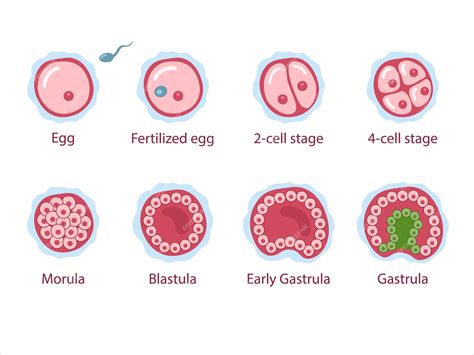 Diagrama mostrando la implantación de un óvulo fertilizado en diferentes ubicaciones de un embarazo ectópico (trompa de Falopio, ovario, abdomen)