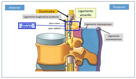 Esquema de la columna vertebral con el espacio epidural y subaracnoideo
